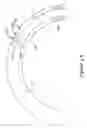 Fig. 07 - FFR sensor head design that minimizes stress induced pressure offsets