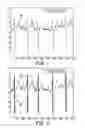 Fig. 04 - Determining onsets and offsets of cardiac depolarization and repolarization waves