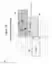Fig. 15 - Pattern recognition system for quantifying the likelihood of the contribution of multiple possible forms of chronic disease to patient reported dyspnea