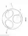 Fig. 07 - Balloon catheter systems and methods