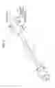 Fig. 02 - Device for treating lumen of living body