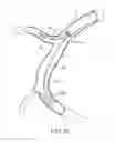 Fig. 09 - DEVICES AND METHODS FOR TREATING CHRONIC TOTAL OCCLUSION