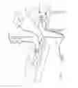 Fig. 02 - Electrosurgical system with suction control apparatus, system and method