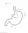 Fig. 08 - Endoscopic device