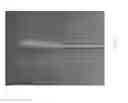 Fig. 167 - ASPIRATION CATHETERS