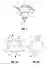 Fig. 02 - EXPANDING ABSORBABLE TACK