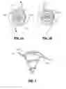 Fig. 03 - EXPANDING ABSORBABLE TACK