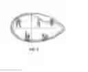 Fig. 04 - Method of mending a groin defect