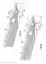 Fig. 17 - Occlusion bypassing apparatuses and methods for bypassing an occlusion in a blood vessel
