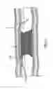 Fig. 18 - Occlusion bypassing apparatuses and methods for bypassing an occlusion in a blood vessel