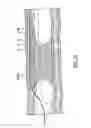 Fig. 24 - Occlusion bypassing apparatuses and methods for bypassing an occlusion in a blood vessel