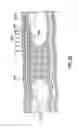 Fig. 25 - Occlusion bypassing apparatuses and methods for bypassing an occlusion in a blood vessel