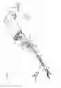 Fig. 12 - Medical Manipulator