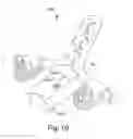 Fig. 10 - Adjustable occipital plate
