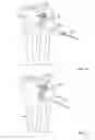 Fig. 16 - Growth control device