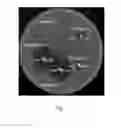 Fig. 02 - Bio-absorbable composite materials containing magnesium and magnesium alloys as well as implants made of said composites
