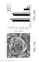 Fig. 09 - Instruments and methods for the implantation of cell-seeded substrates
