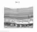 Fig. 63 - Instruments and methods for the implantation of cell-seeded substrates