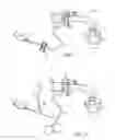 Fig. 06 - SPEAKING VALVE SYSTEM WITH CUFF DEFLATION