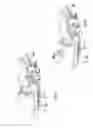 Fig. 09 - Patient support device for prone immobilization