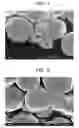Fig. 02 - Spherical silver powder and method for producing same