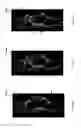 Fig. 43 - Skin stretch feedback devices, systems, and methods