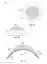 Fig. 02 - Multicomponent optical device having a space