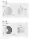 Fig. 09 - Image processing for facilitating identification of colors using patterned regions