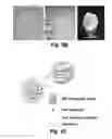 Fig. 07 - TECHNOLOGIES FOR PANCREATIC ISLET TRANSPLANTATION