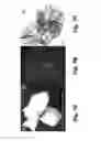 Fig. 09 - TECHNOLOGIES FOR PANCREATIC ISLET TRANSPLANTATION