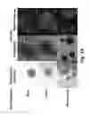 Fig. 19 - TECHNOLOGIES FOR PANCREATIC ISLET TRANSPLANTATION