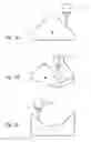 Fig. 02 - Method for making a decorative multilaminar veneer