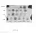 Fig. 07 - Therapeutic nuclease compositions and methods