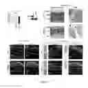 Fig. 02 - Compositions and methods for the treatment of retinal degeneration