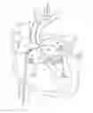 Fig. 01 - APPARATUS FOR SAFE PERFORMANCE OF TRANSSEPTAL TECHNIQUE AND PLACEMENT AND POSITIONING OF AN ABLATION CATHETER