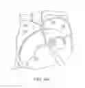 Fig. 08 - APPARATUS FOR SAFE PERFORMANCE OF TRANSSEPTAL TECHNIQUE AND PLACEMENT AND POSITIONING OF AN ABLATION CATHETER
