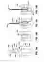 Fig. 22 - Methods and devices for repairing and anchoring damaged tissue