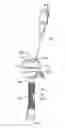 Fig. 01 - Devices, systems, and methods for providing surgical access and facilitating closure of surgical access openings