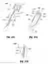 Fig. 40 - Devices, systems, and methods for providing surgical access and facilitating closure of surgical access openings