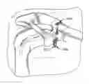Fig. 01 - Surgical fastening