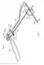 Fig. 02 - Surgical fastening