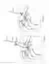 Fig. 06 - Surgical fastening