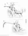 Fig. 07 - Surgical fastening