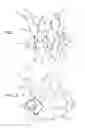 Fig. 02 - Vascular prosthesis for treating aneurysms
