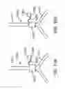 Fig. 08 - Devices and methods for assisting valve function, replacing venous valves, and predicting valve treatment success