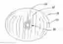 Fig. 01 - Mucosal capture fixation of medical device
