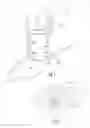 Fig. 02 - Mucosal capture fixation of medical device