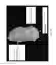 Fig. 09 - Bone regeneration using biodegradable polymeric nanocomposite materials and applications of the same