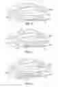 Fig. 07 - Sole structure for an article of footwear