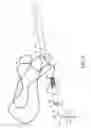 Fig. 04 - Fishing pole system and method of use